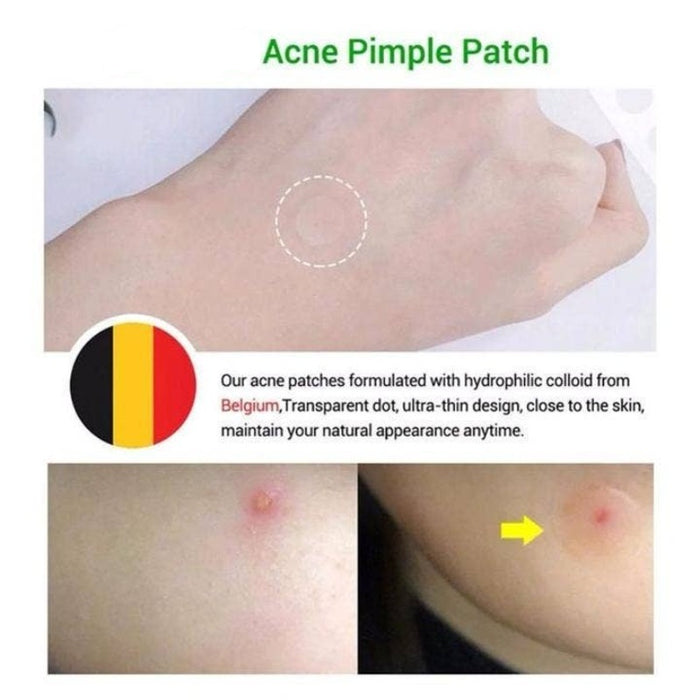 Tea Tree Pimple Extraction Patch